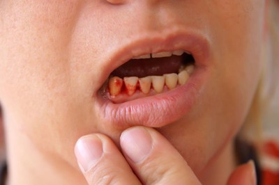 Bệnh ngoài da và niêm mạc miệng do virus ở trẻ em